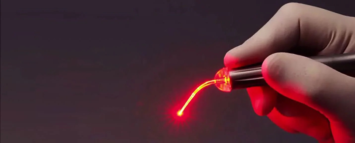 Laser Implantation