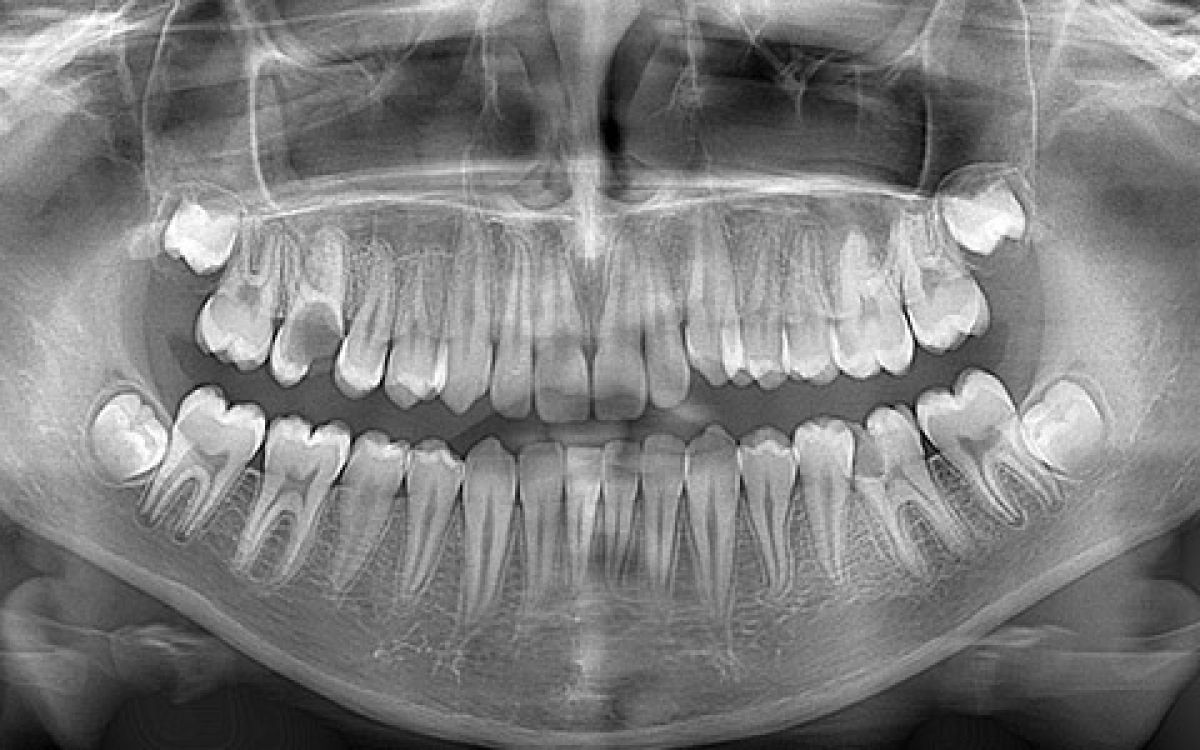 Oral Diagnosis and Radiology